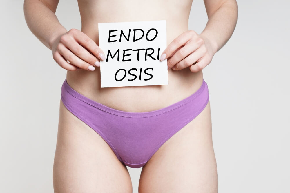 What is the Best Fertility Treatment for Endometriosis? Fertility