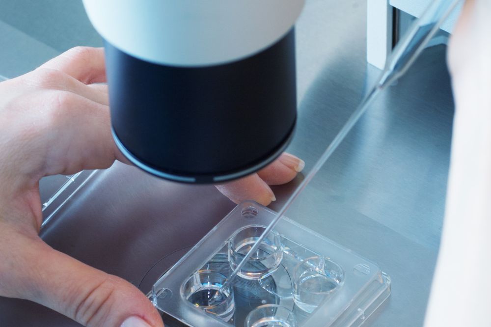 Advantages of Artificial Insemination - Fertility Treatment Clinic